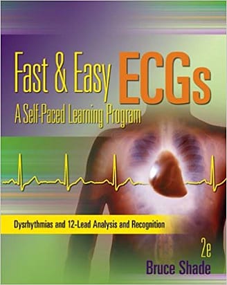 Official Test Bank For Fast and Easy ECGs By Shade 2nd Edition