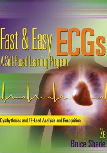 Official Test Bank For Fast and Easy ECGs By Shade 2nd Edition
