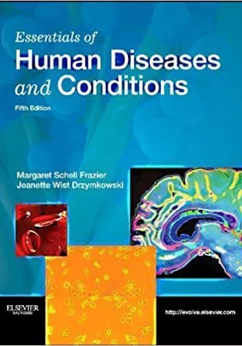 Official Test Bank for Essentials of Human Diseases and Conditions By Frazier 5th Edition